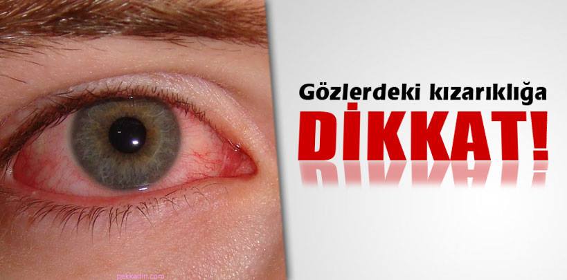 Gözlerdeki kızarıklığa dikkat