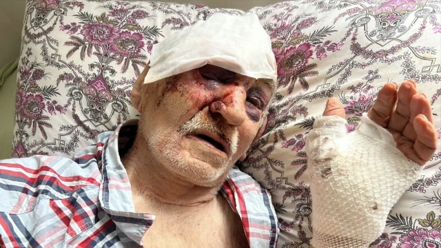 Araklı'da Kazada Ölümden Döndü
