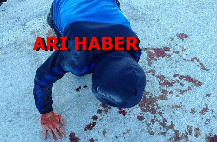 ARAKLI’DA BU ÇOCUĞUN BAŞINA GELE’NİN HESABINI KİM VERECEK