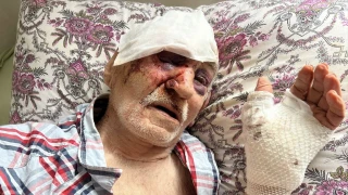 Araklı'da Kazada Ölümden Döndü